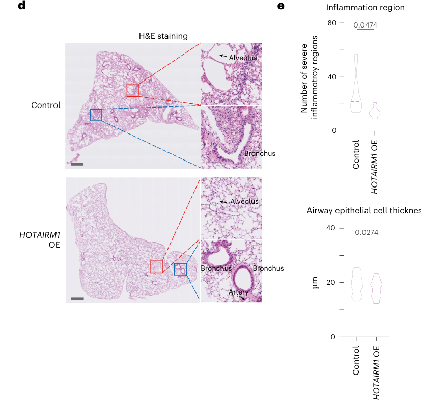 Histopathology figure showing nominally reduced inflammation in HOTAIRM1-OE treated fibrotic mouse lung